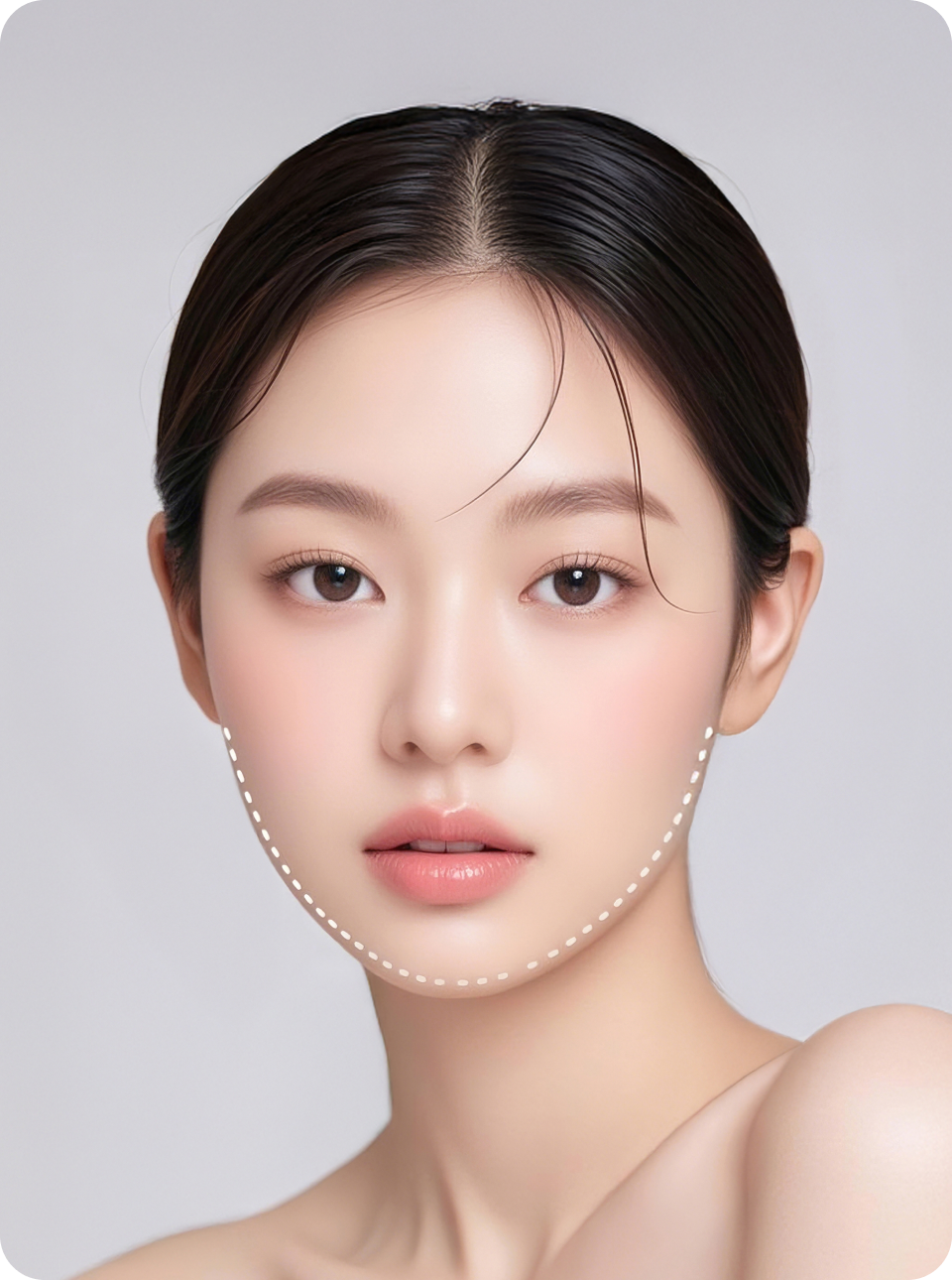 리엔장 텐써마 10THERMA 리프팅 장비